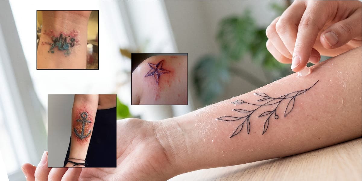 Infection — How to Catch It Early and What to Do