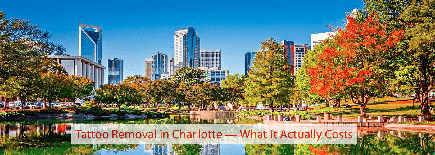 Tattoo Removal in Charlotte — What It Actually Costs