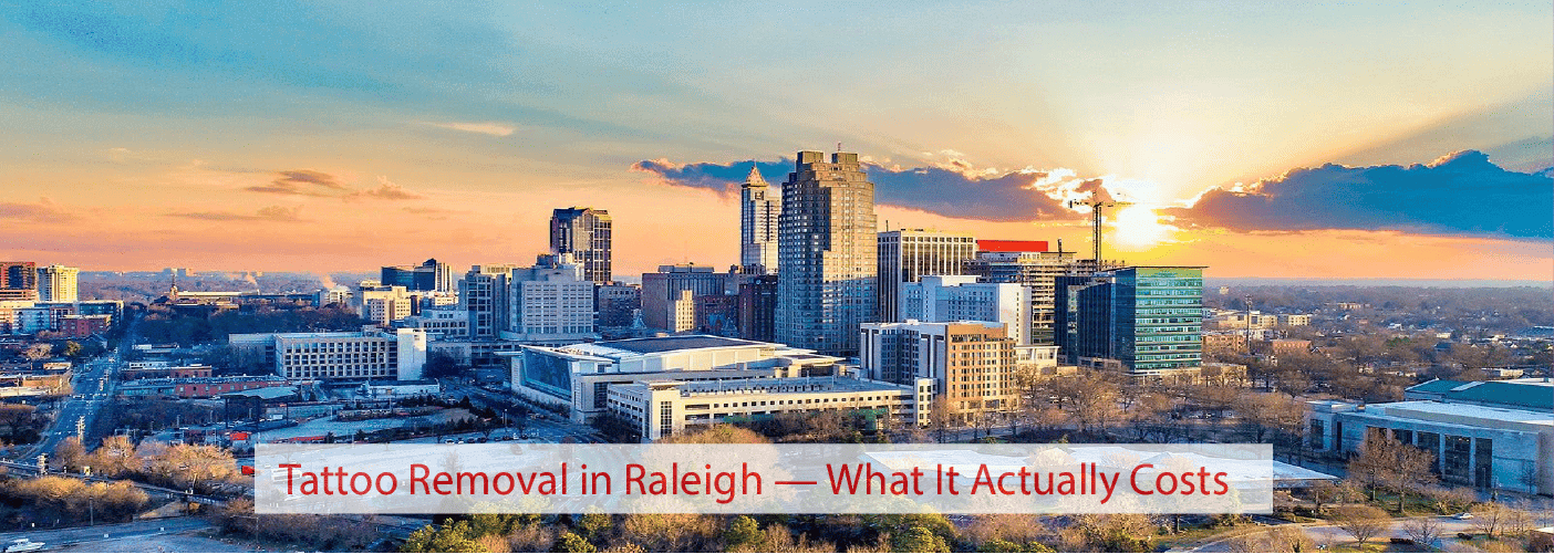 Tattoo Removal in Raleigh — What It Actually Costs
