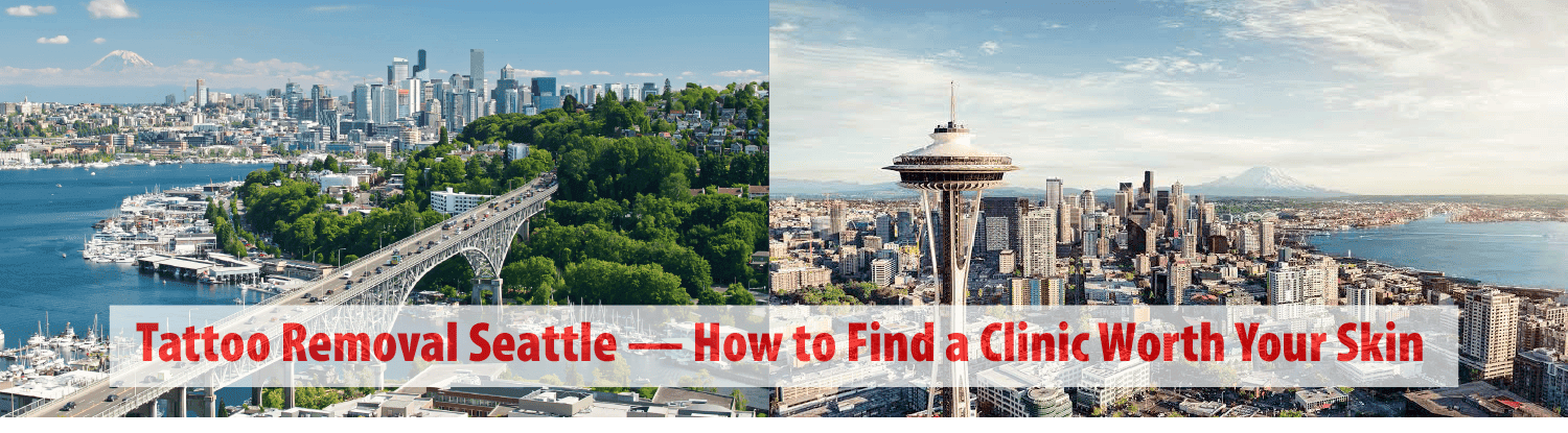 Tattoo Removal Seattle — How to Find a Clinic Worth Your Skin
