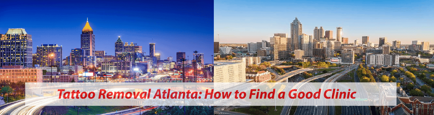Tattoo Removal Atlanta — How to Find a Clinic That Knows Your Skin and Your Sun
