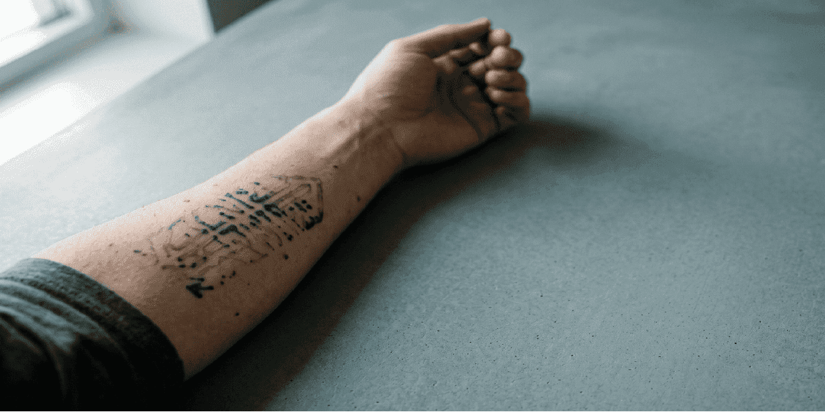 Many Sessions Does It Take to Remove a Tattoo (2026)