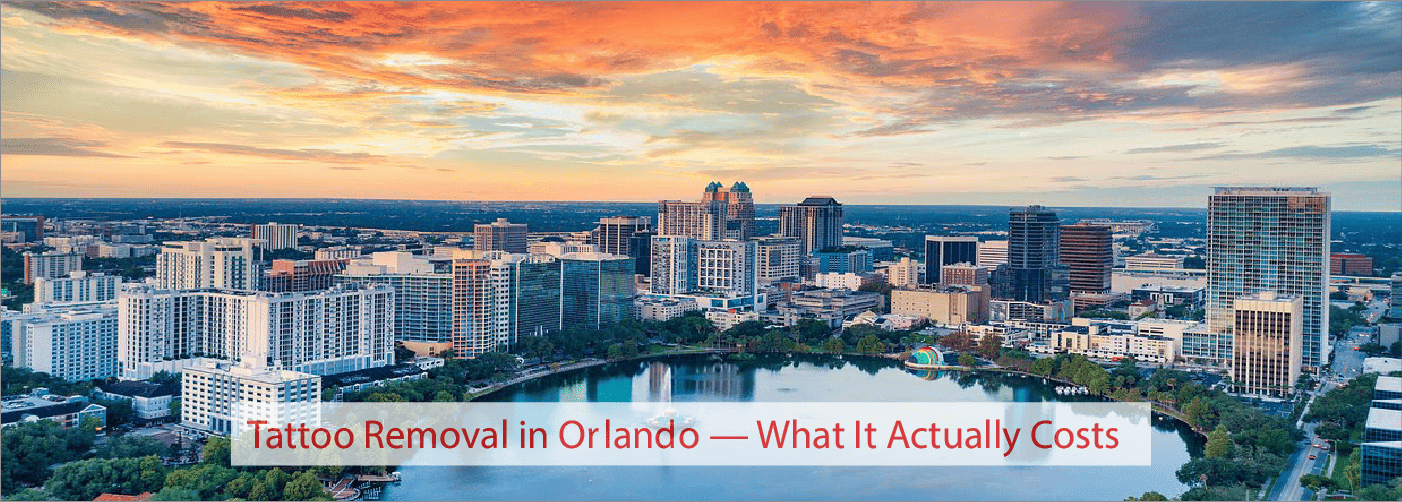 Tattoo Removal in Orlando — What It Actually Costs