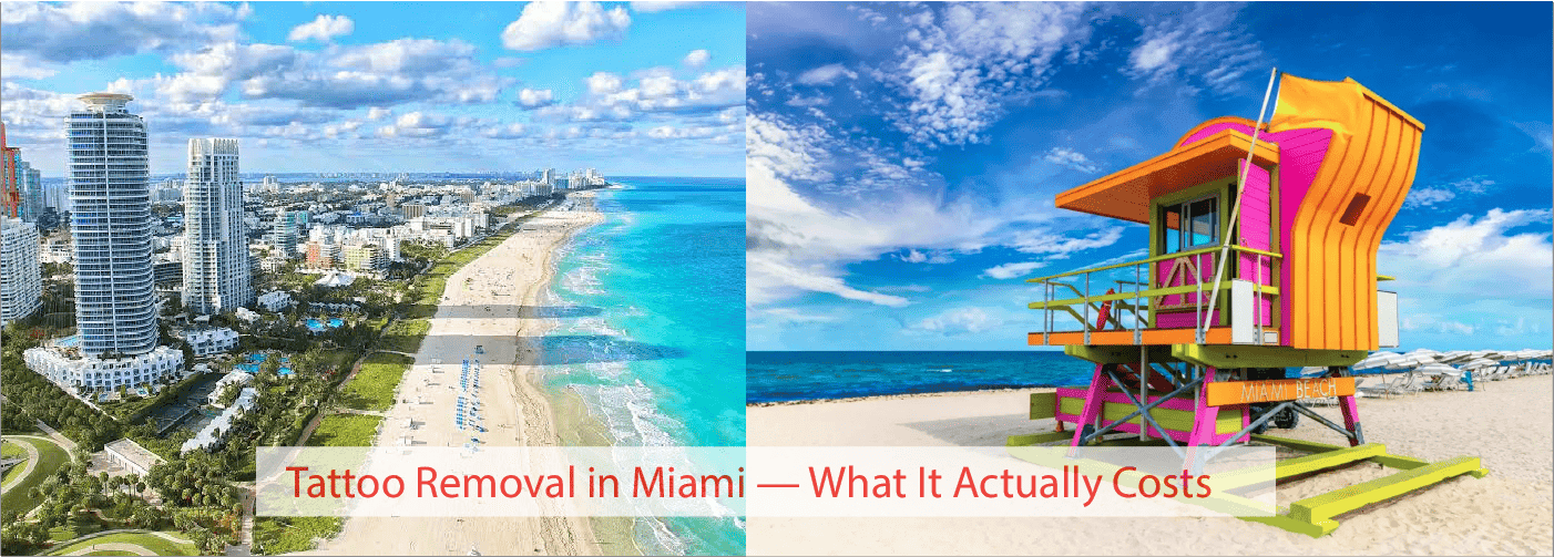 Tattoo Removal in Miami — What It Actually Costs