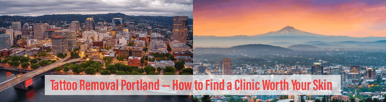 Tattoo Removal Portland — How to Find a Clinic Worth Your Skin